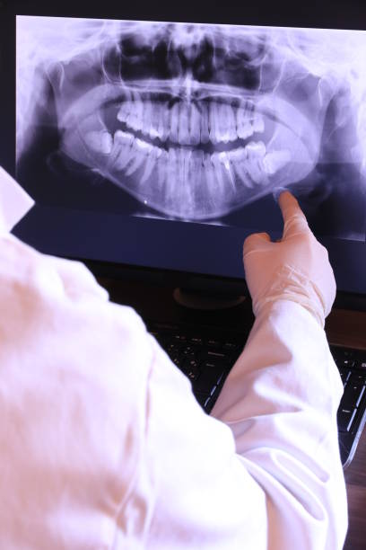 Best Emergency Wisdom Teeth Removal in Chesterland, OH