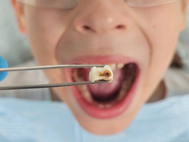 Best Pediatric Emergency Dentist in Chesterland, OH