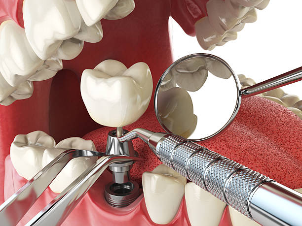 Best Emergency Gum Treatment in Chesterland, OH